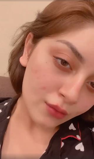 Alizeh Shah Opens Up About Her Struggle With Acne