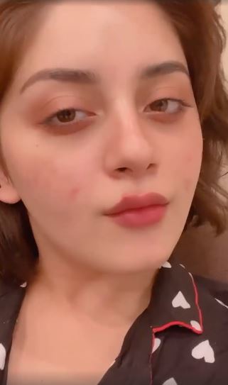 Alizeh Shah Opens Up About Her Struggle With Acne