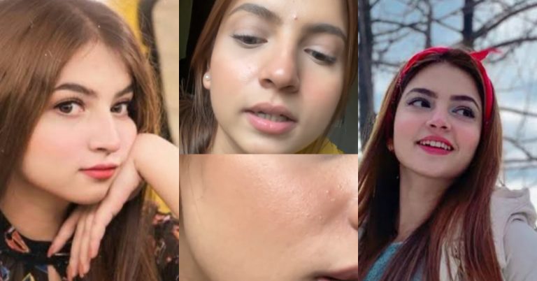 Dananeer Mubeen Opens Up About The Idea Of Flawless Skin