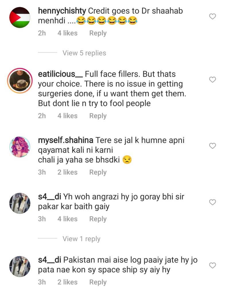 Mathira Denies Getting Plastic Surgeries - Comments