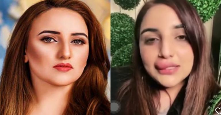 Hareem Shah’s Lip Filler Procedure Gone Wrong