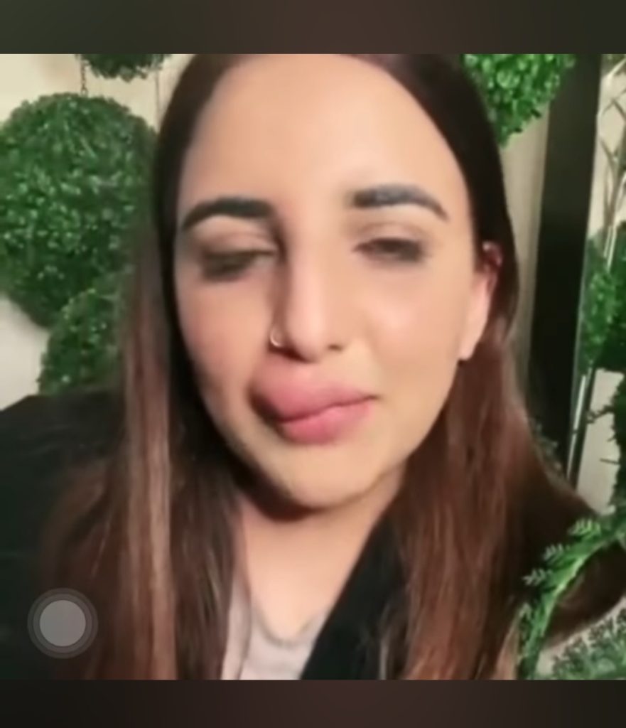 Hareem Shah’s Lip Filler Procedure Gone Wrong