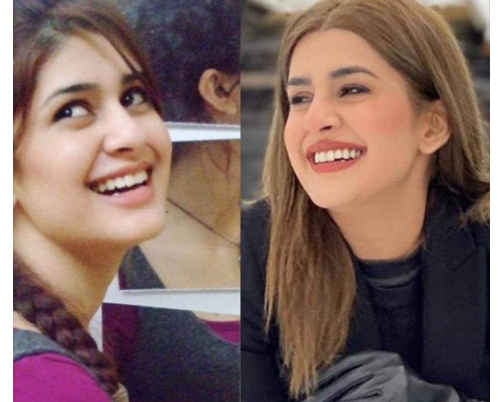 Kubra Khan Shares Thoughts About Having Cosmetic Surgery