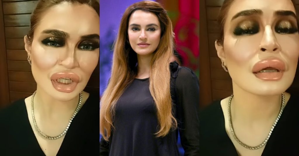 Nadia Hussain's Take on Lip Fillers Gets Mixed Public Response