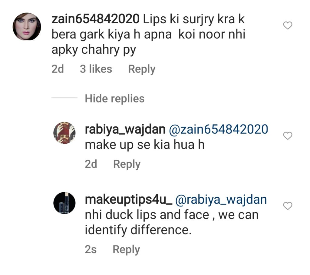 Nida Yasir's Lip Fillers Criticized by Public