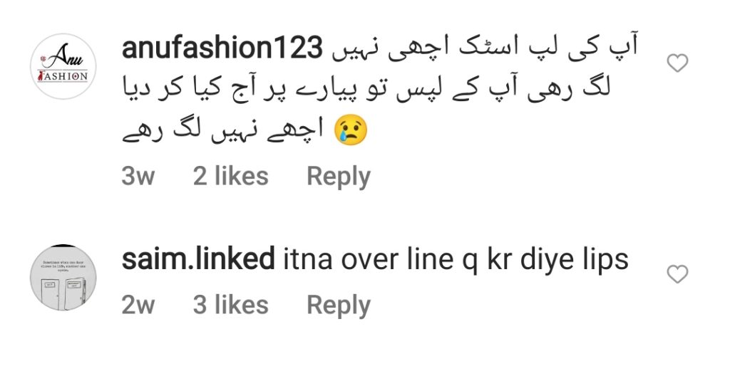 Nida Yasir's Lip Fillers Criticized by Public