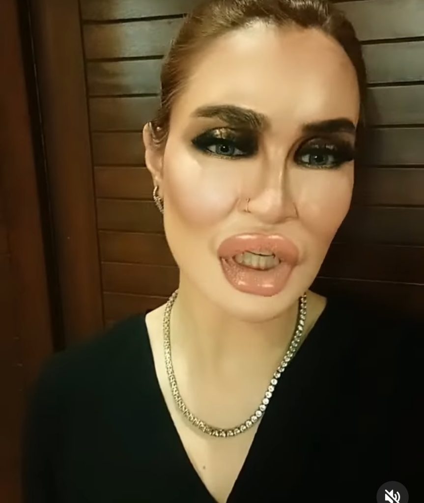 Nadia Hussain's Take on Lip Fillers Gets Mixed Public Response