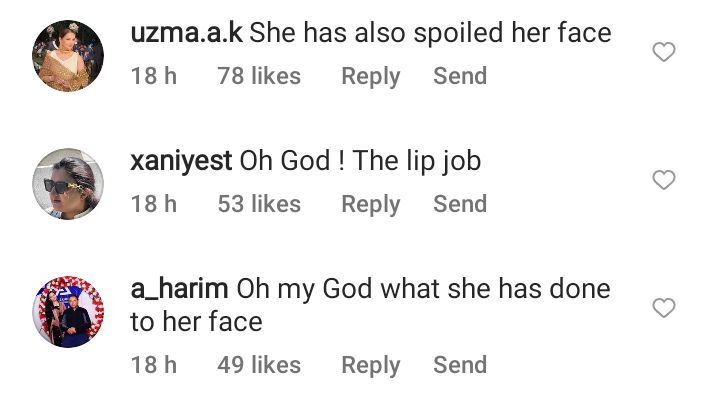 Netizens Not Impressed With Naimal Abbasi's Lip Fillers
