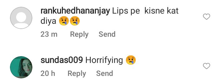 Netizens Not Impressed With Naimal Abbasi's Lip Fillers