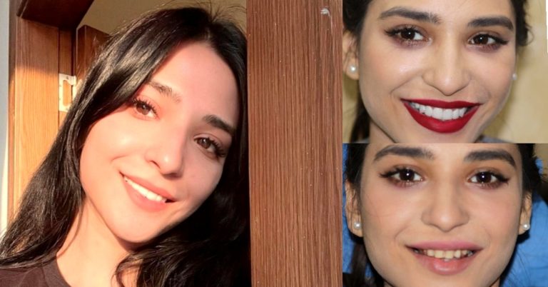Actress Ramsha Khan Smile Before & After Fixing Teeth