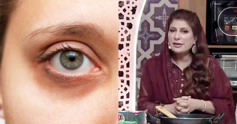Magical Tip To Get Rid Of Dark Circles