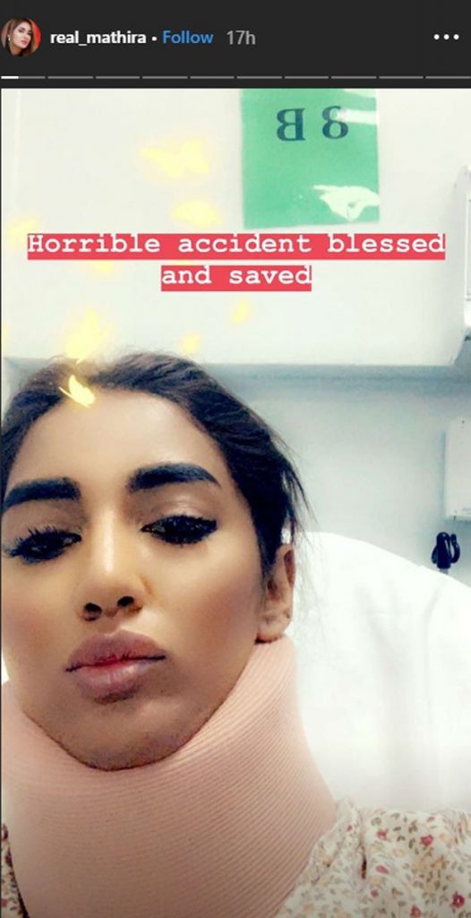 Mathira Opens Up About Her Horrible Accident
