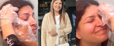 Shagufta Ejaz Shares Details About Getting Botox