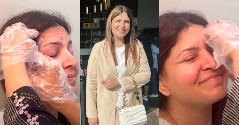 Shagufta Ejaz Shares Details About Getting Botox