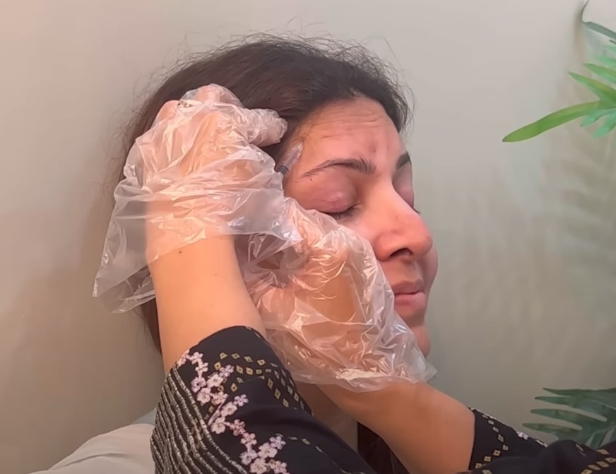 Shagufta Ejaz Shares Details About Getting Botox