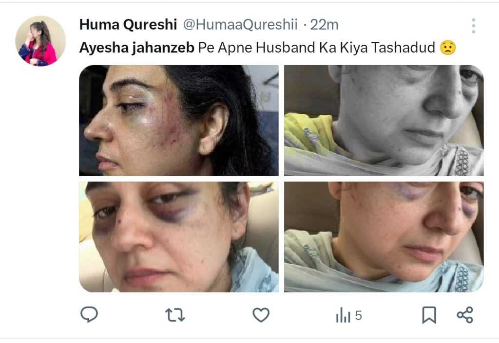 Public Renders Support to Host Ayesha Jehanzeb after Domestic Abuse