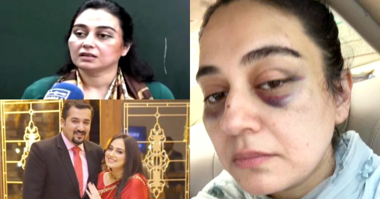 Ayesha Jehanzeb Badly Injured By Husband – Disturbing Details