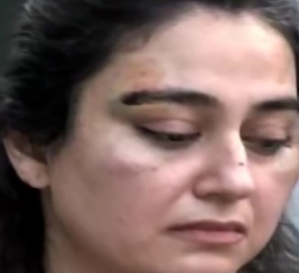 Ayesha Jehanzeb Badly Injured By Husband - Disturbing Details