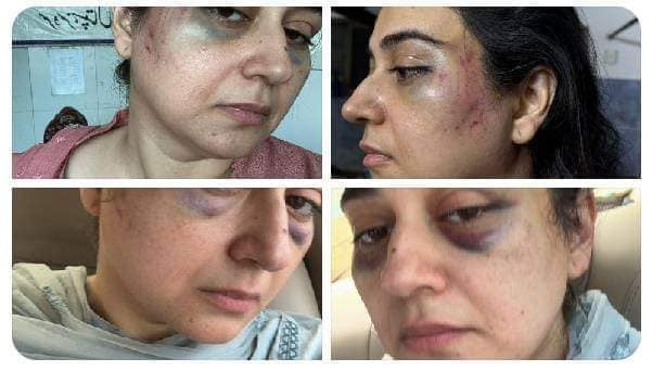Ayesha Jehanzeb Badly Injured By Husband - Disturbing Details