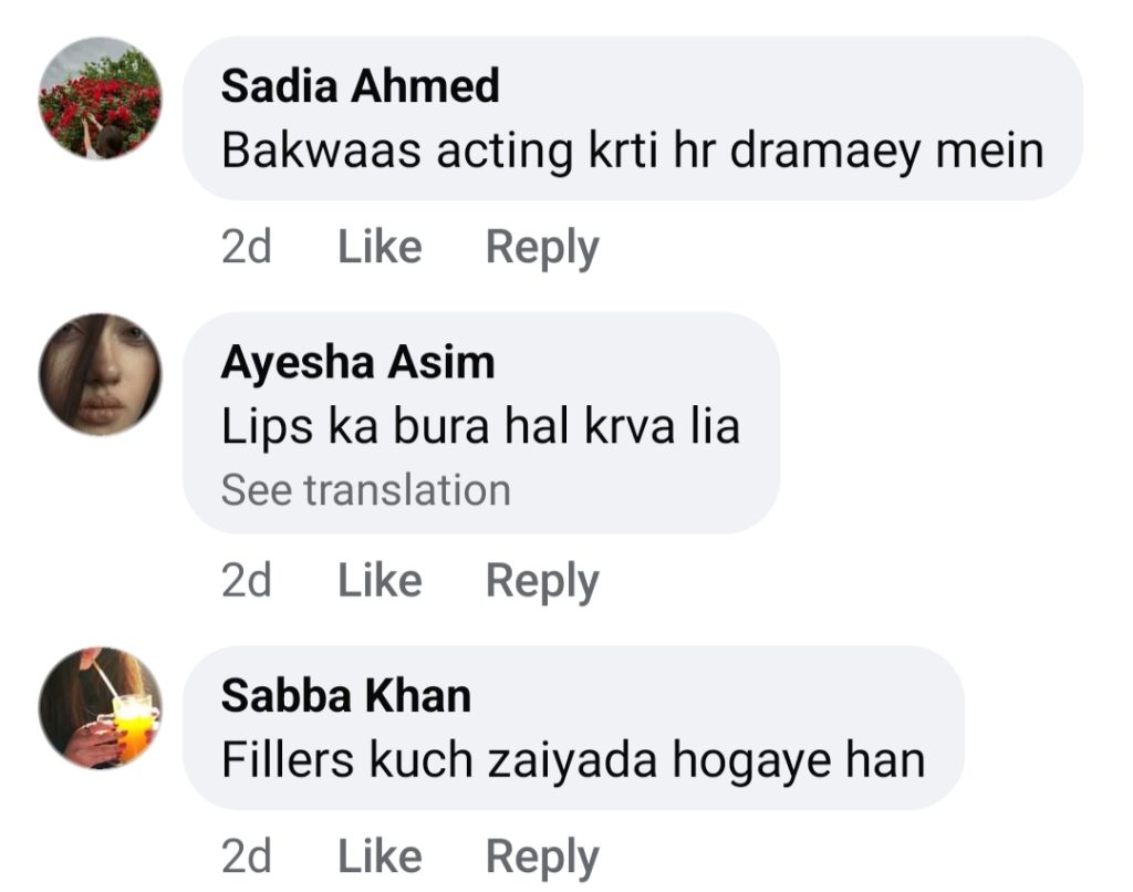 Zoya Nasir's Performance & Lip Fillers In Noor Jahan Heavily Criticized