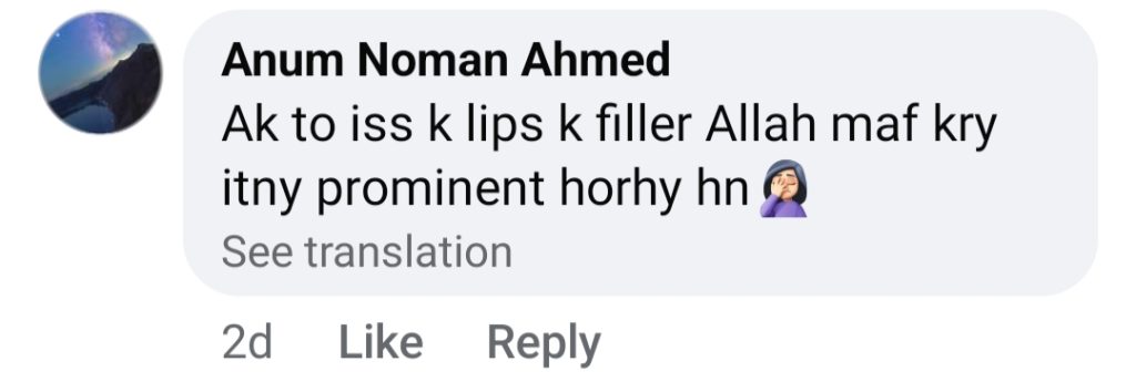 Zoya Nasir's Performance & Lip Fillers In Noor Jahan Heavily Criticized