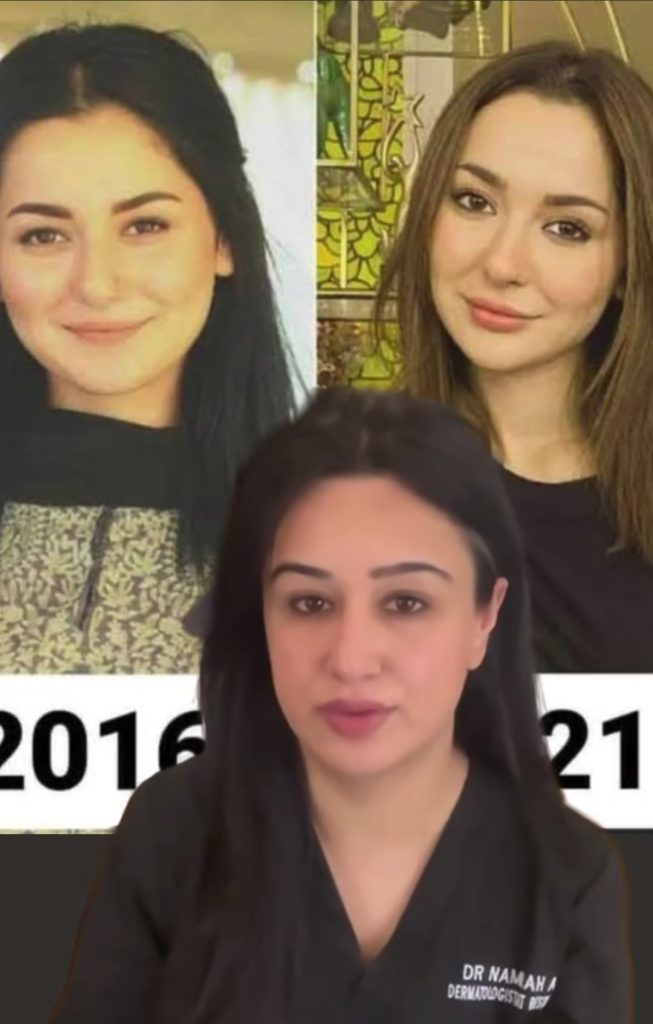 Hania Aamir Before & After Her Surgery