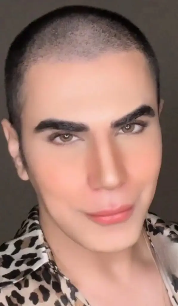 Ken Doll's Latest Cosmetic Procedures Under Severe Scrutiny