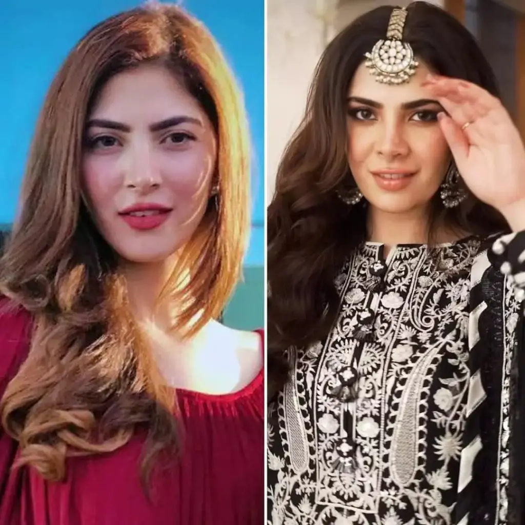 Latest Cosmetic Procedures of Pakistani Celebrities