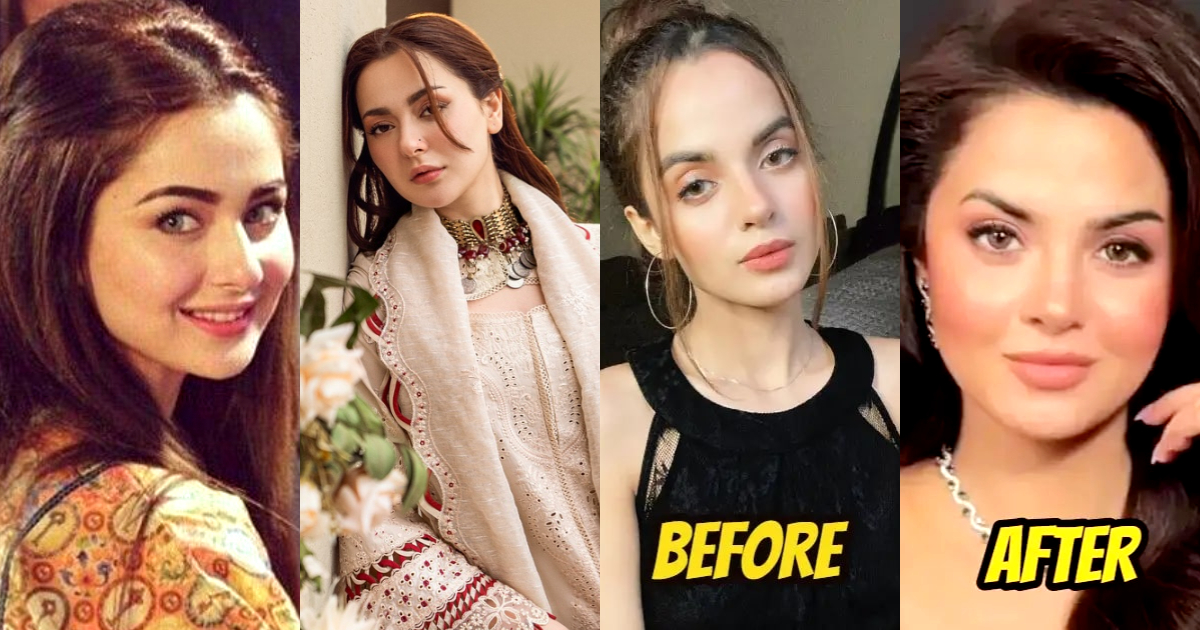 Latest Cosmetic Procedures of Pakistani Celebrities