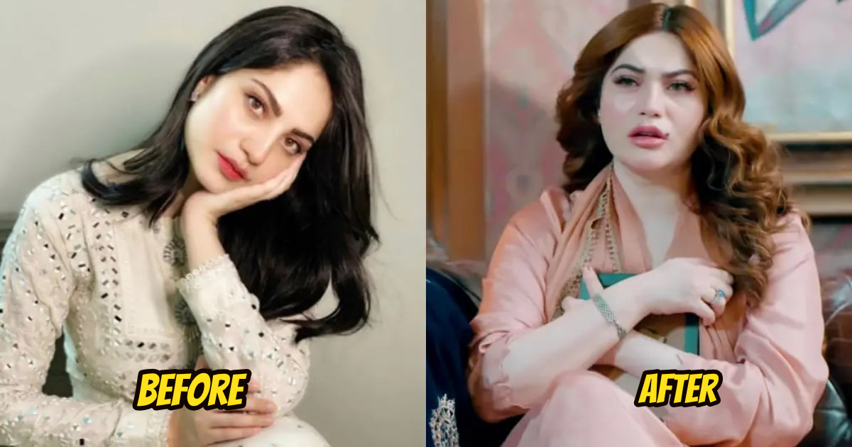 Neelam Muneer’s Plastic Surgery Disaster In Mehshar