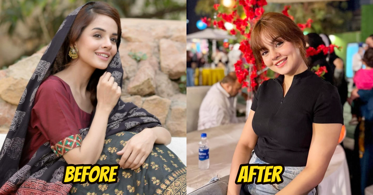 Komal Meer’s New Dimples Spark Debate