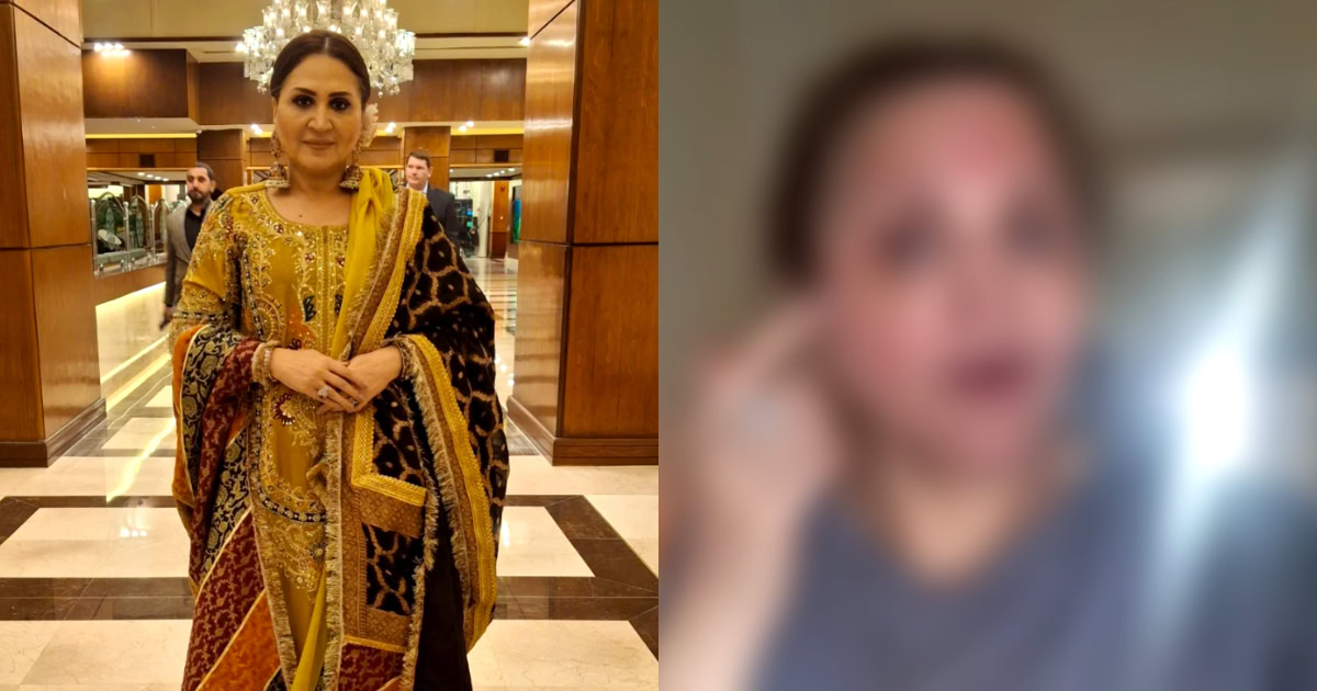 asma-abbas Asma Abbas’s Skin Procedure Goes Wrong
