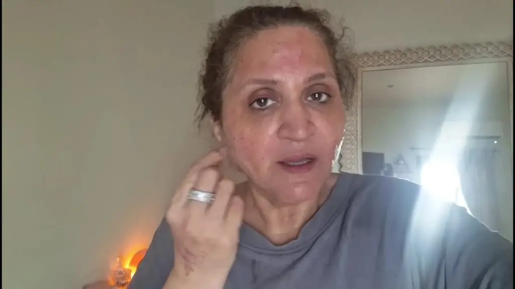 Asma Abbas’s Skin Procedure Goes Wrong