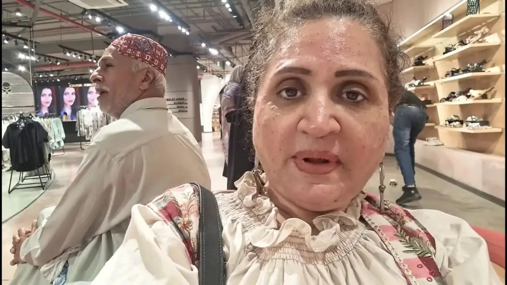 Asma Abbas’s Skin Procedure Goes Wrong