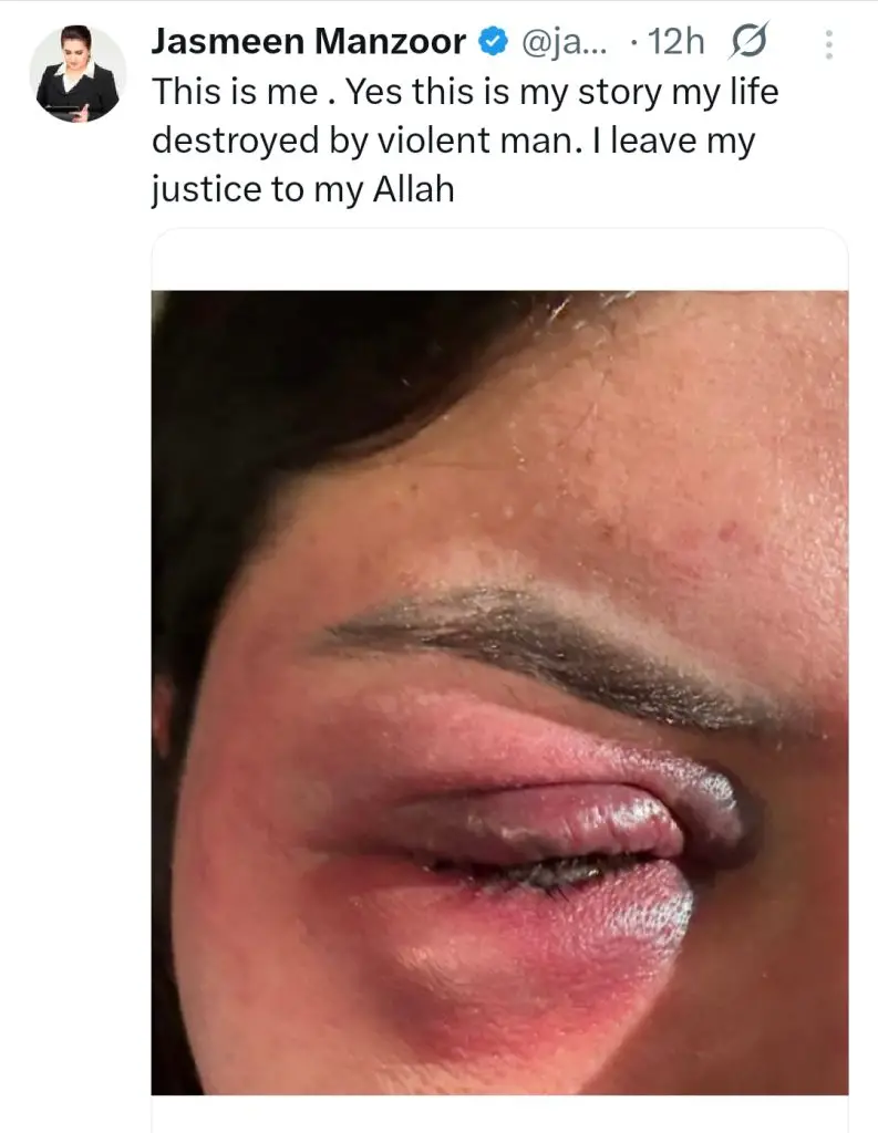 Jasmeen Manzoor Shares Domestic Brutality She Faced