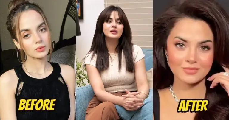 Komal Meer Addresses Face Change In Detail