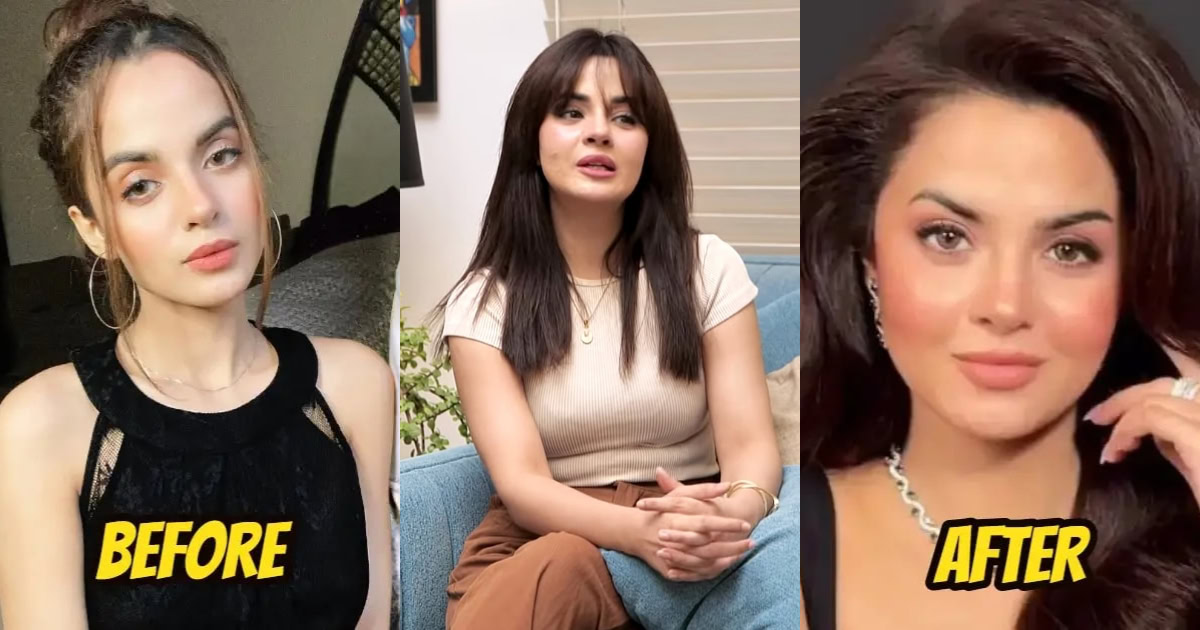 Komal Meer Addresses Face Change In Detail