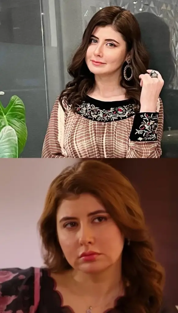 Najiba Faiz’s Look Before & After Cosmetic Surgery