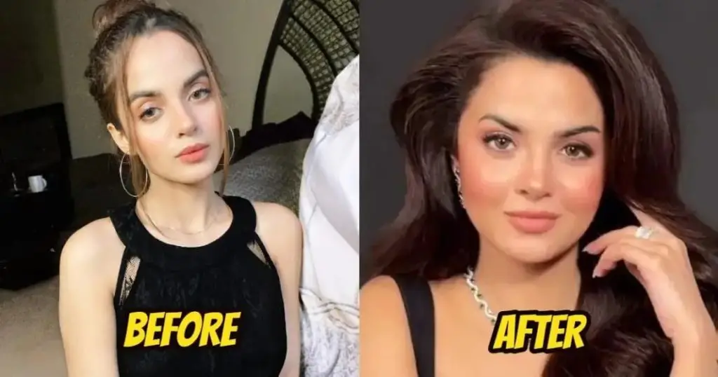 Pakistani Celebrities Who Deny Getting Plastic Surgery