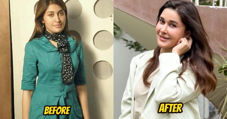 Internet Notices Change In Shaista Lodhi’s Nose