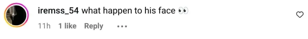 Internet Feels Zuhab Khan’s Face Changed Again