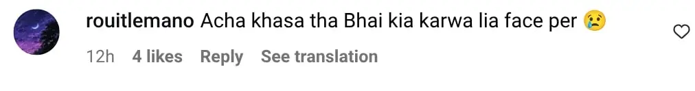 Internet Feels Zuhab Khan’s Face Changed Again