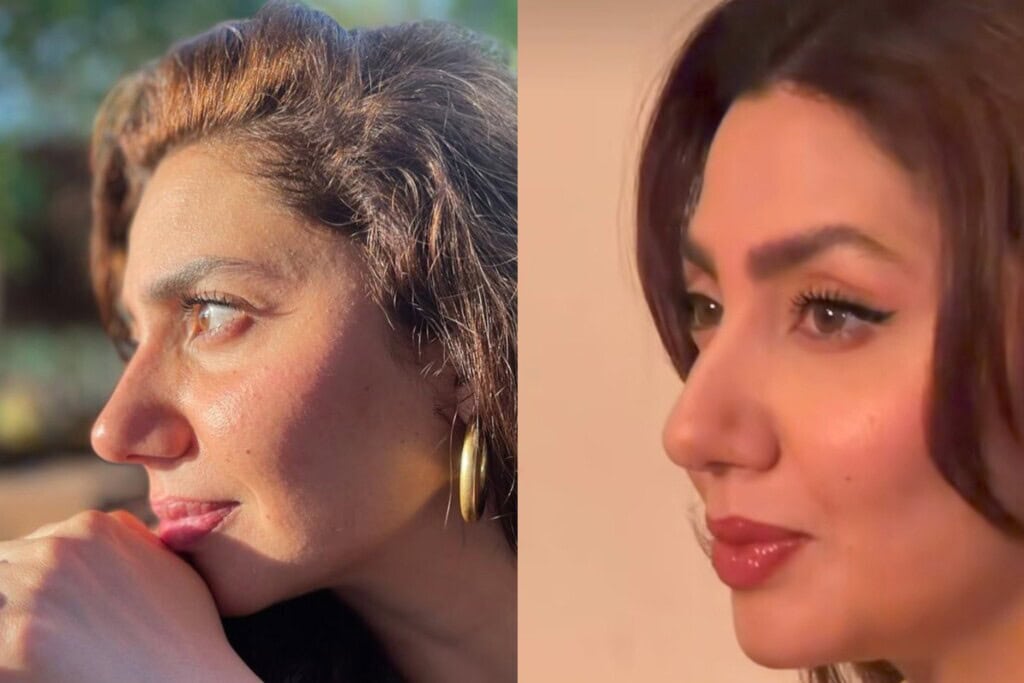 Mahira Khan’s Eyebrow Lift & Fillers Spark Debate