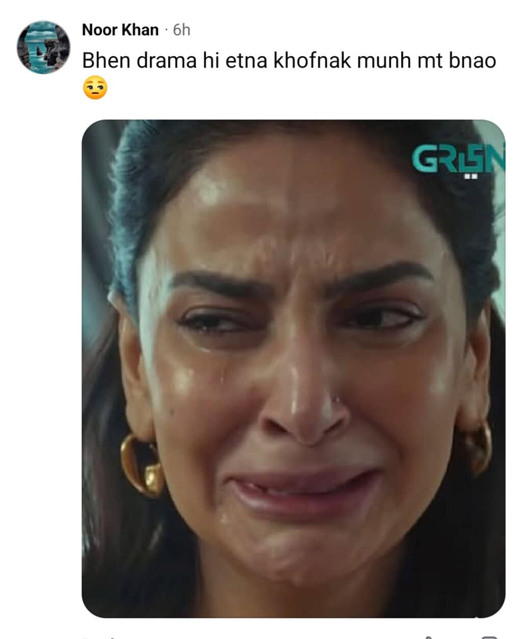 Dubai Based Doctor Analyzes Saba Qamar’s Botox Crying in Pamaal