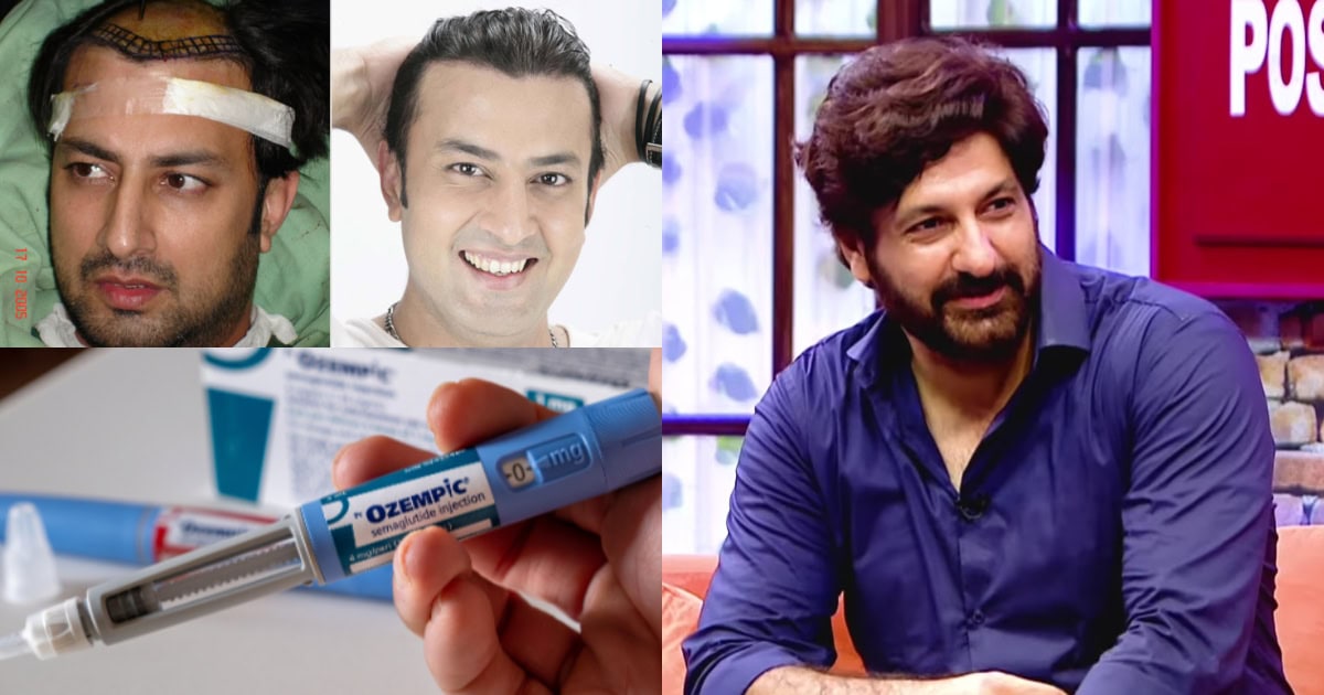 Syed Jibran’s Take On Actors Using Ozempic & Hair Patches
