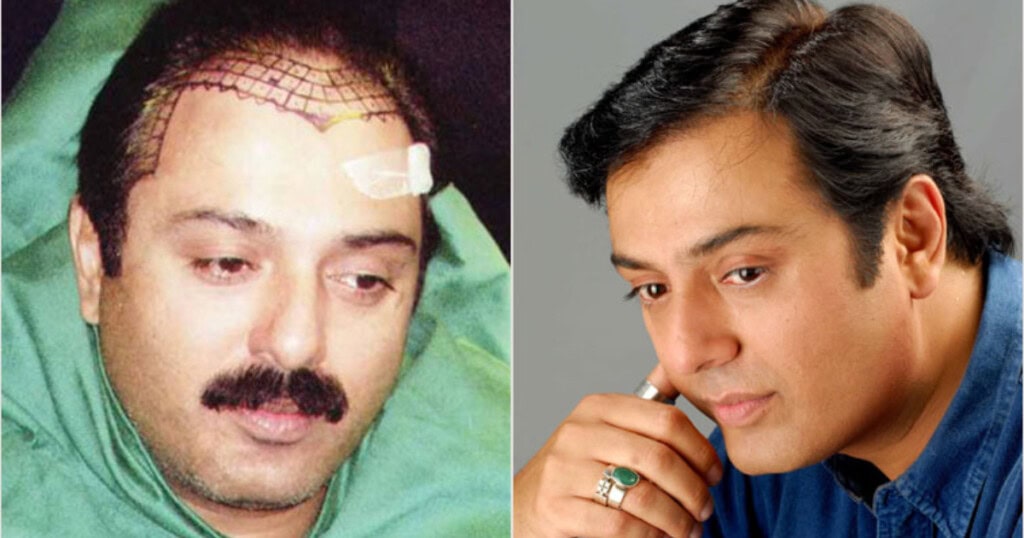 Syed Jibran’s Take On Actors Using Ozempic & Hair Patches