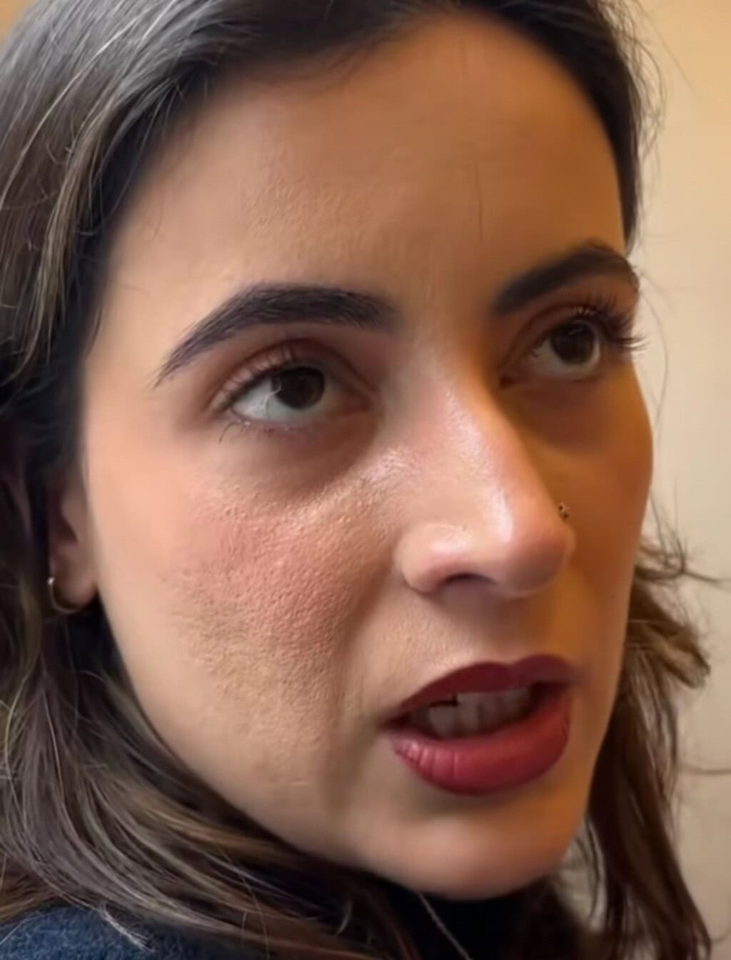 Anya Hamza Ali’s Textured Skin Raises Questions