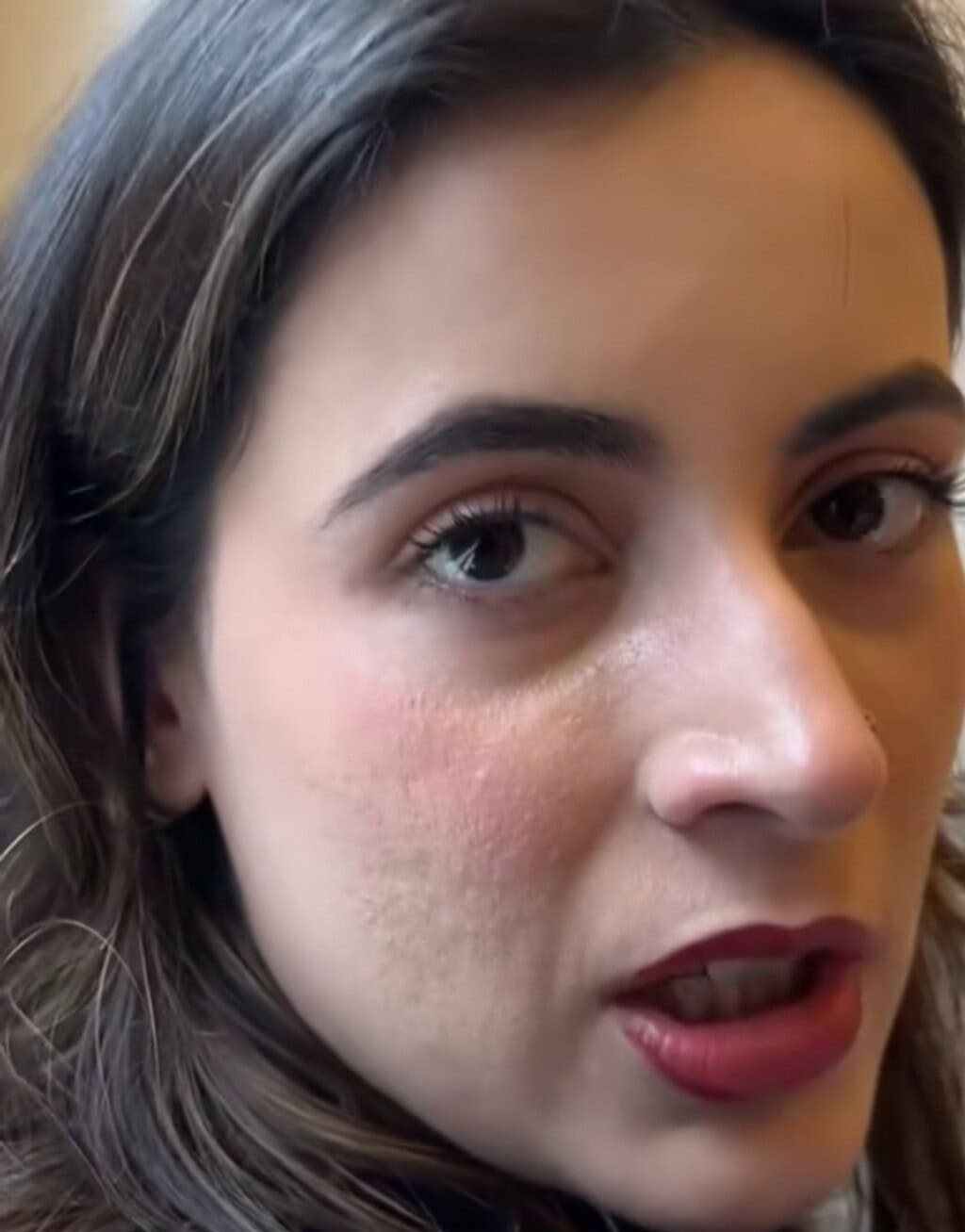 Anya Hamza Ali’s Textured Skin Raises Questions