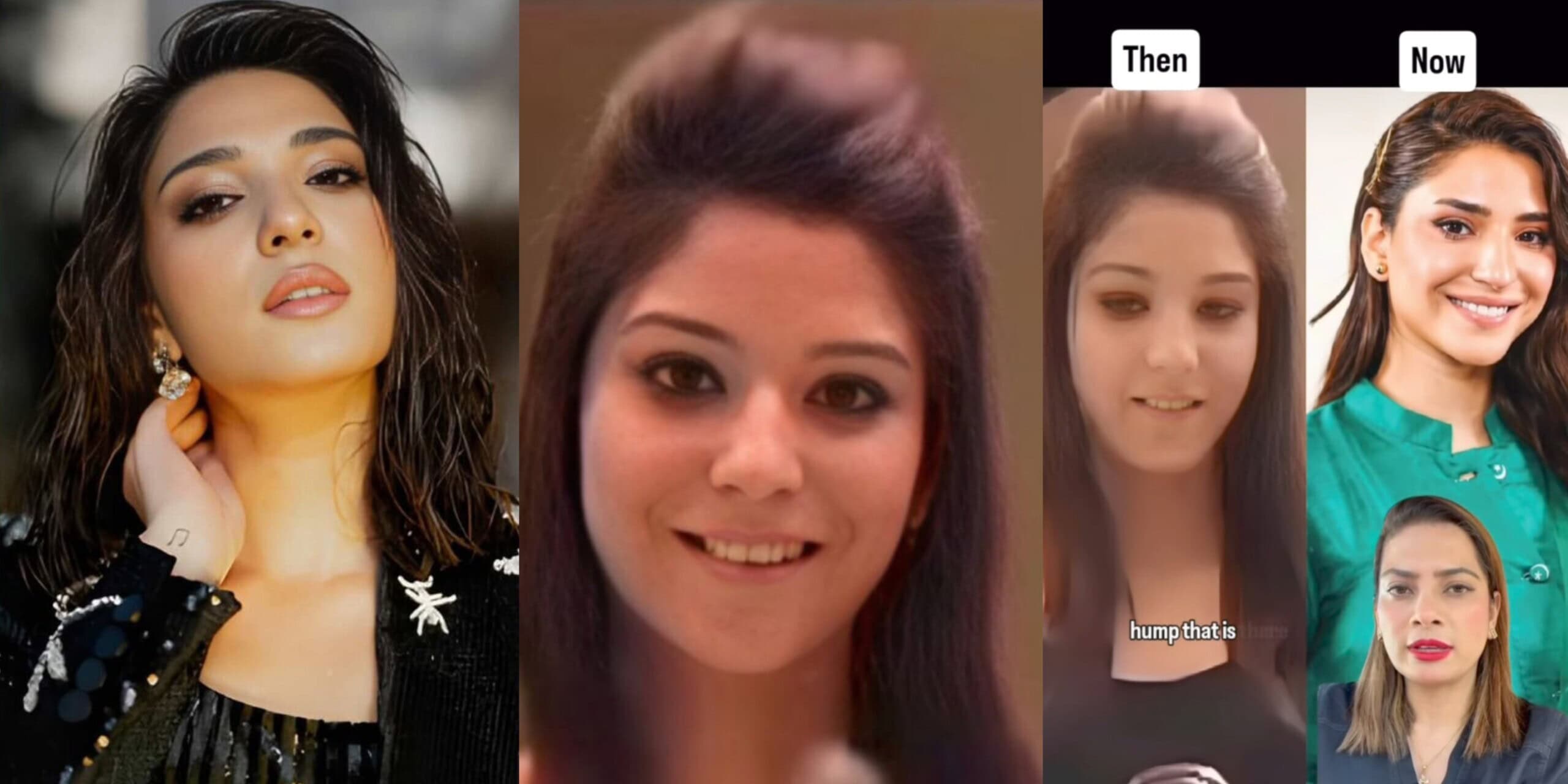 Ramsha Khan Cosmetic Surgeries Explained by Dermatologist