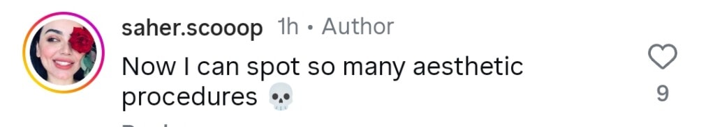 Ramsha Khan’s Old Clip Highlights her Cosmetic Procedures